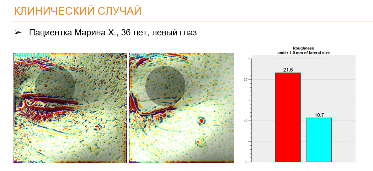 SPRS антера Снимок экрана 2026-09-30 152931.png