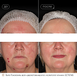 вибим тонаканян