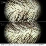 трихология джахая2