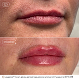 кп губ Чукова