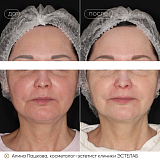 скинова пашкова