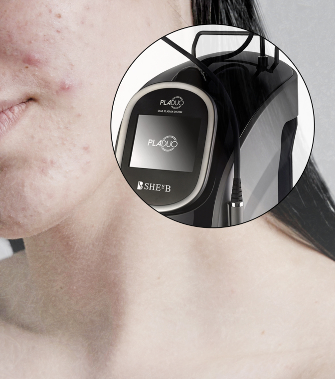 -15 % на лечение акне PLADUO