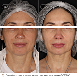 ексион соколова