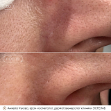 вибим чукова2