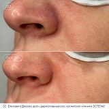 вибим джахая