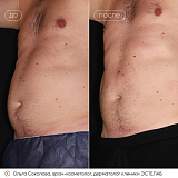 крио соколова