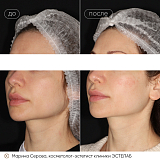 скинова серова