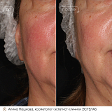 хелео пашкова