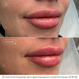 патрикеева кп2