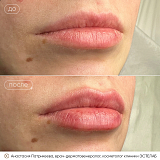 кп патрикеева