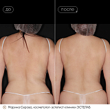 крио серова