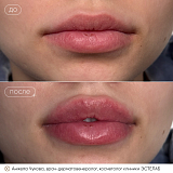 чукова кп8