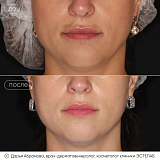 пикошур абрамова