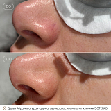 вибим абрамова2