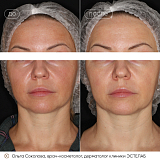 пикоквин соколова