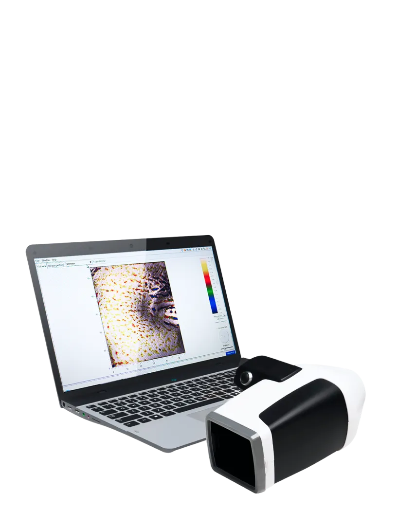 Antera 3D
